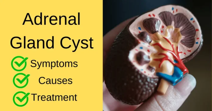 Adrenal Gland Cyst