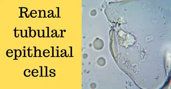 Renal tubular epithelial cells