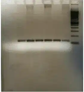 Troubleshooting DNA Gel Electrophoresis