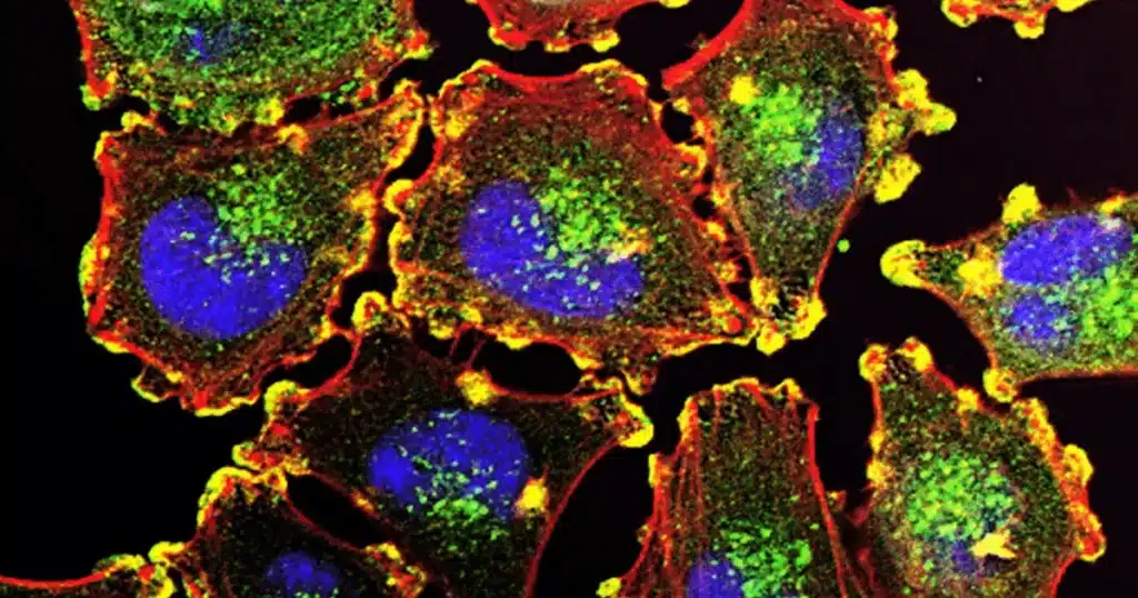 Minimal Essential Medium in cell culture