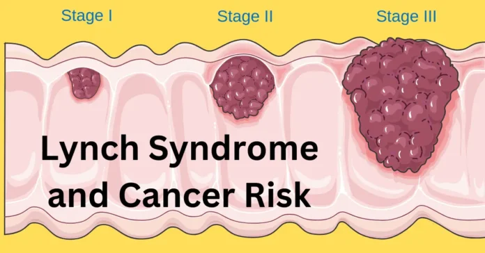 lynch syndrome and cancer risk