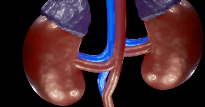 adrenal carcinoma