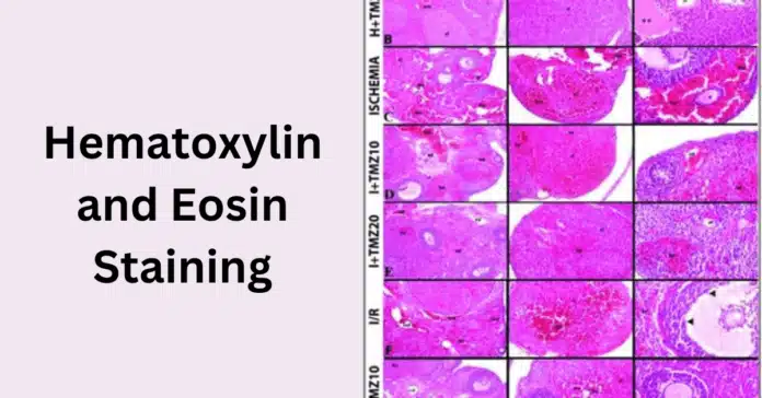 Hematoxylin and Eosin Staining