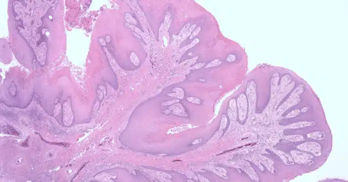 Histological Staining Techniques in Cancer Research Methods and Applications