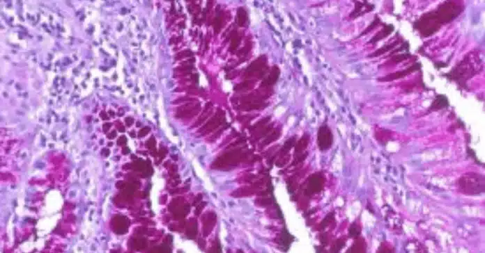 PAS Staining Principles, Protocol, and Applications in Histology