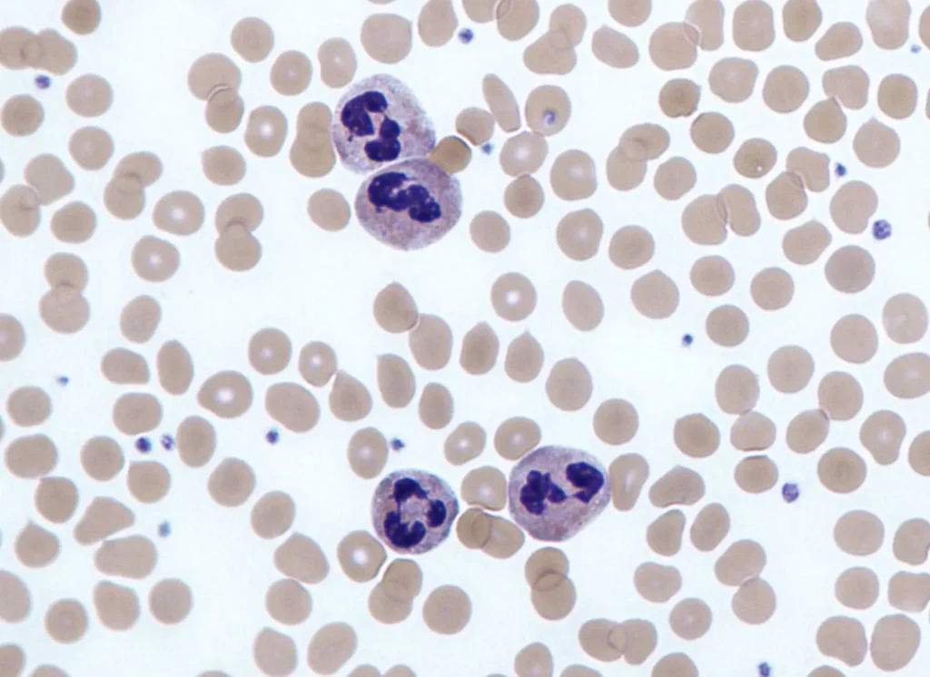 Microscopic view of a peripheral blood smear showing several neutrophils with multi-lobed nuclei (segmented nuclei) stained dark purple, surrounded by numerous pale pink red blood cells.