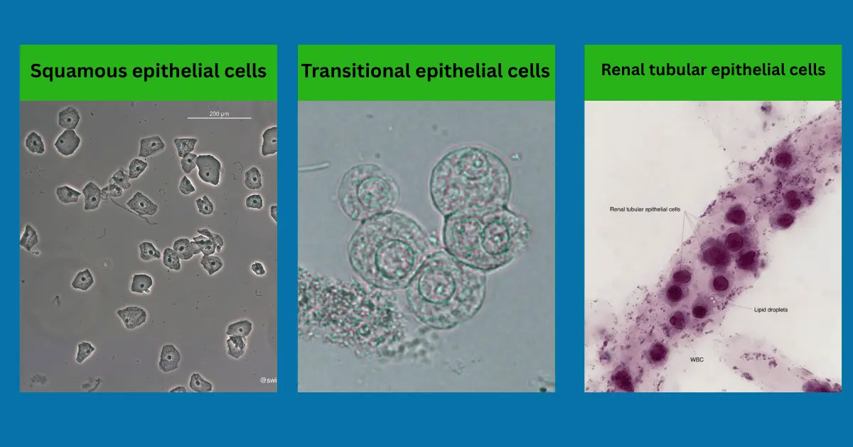 Different types of epithelial cells found in urine histology slides