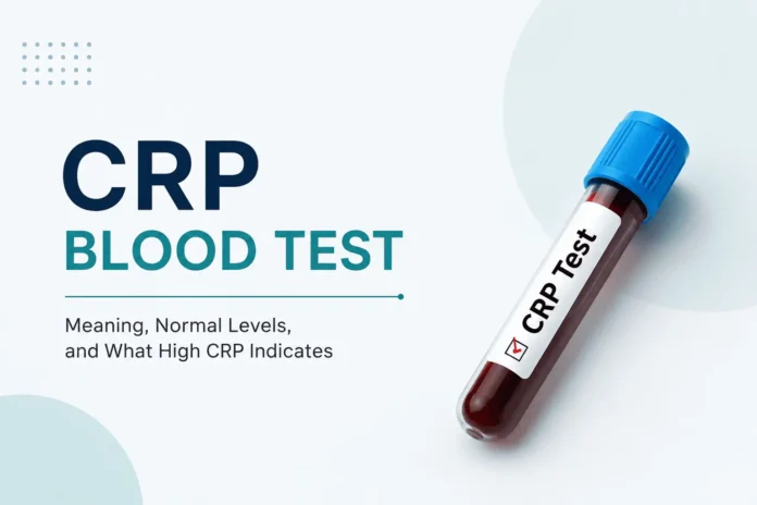 Minimalist medical cover image showing the title “CRP Blood Test” with a subtitle about meaning and normal levels, alongside a realistic blood sample tube labeled “CRP Test” on a clean, light background with soft blue design elements.