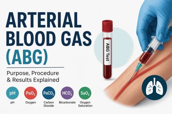 arterial-blood-gas-abg