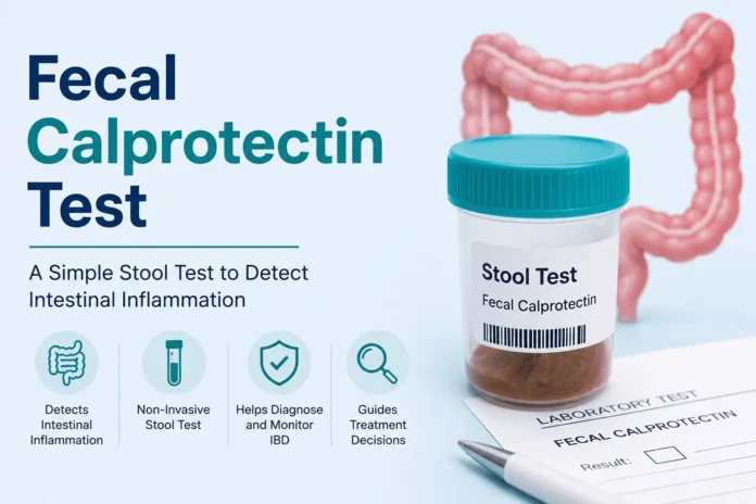Illustration of a fecal calprotectin stool test used to detect intestinal inflammation and monitor inflammatory bowel disease.
